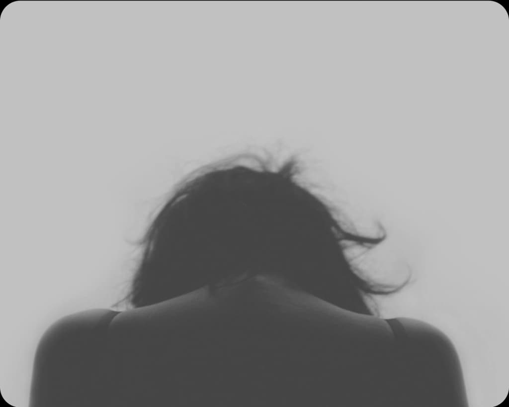 Bipolar II Disorder: