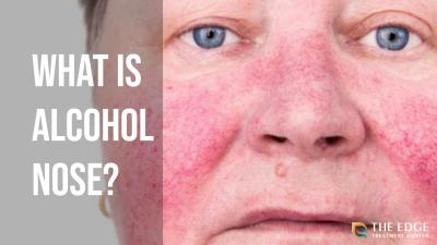 Alcohol nose is one of the most recognizable symptoms of excessive drinking. Learn more about alcohol nose, alcoholism, and more in our blog.