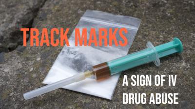 Track marks are the reddest of red flags when it comes to addiction. Track marks are a sign of IV drug use, the deadliest form of substance abuse.