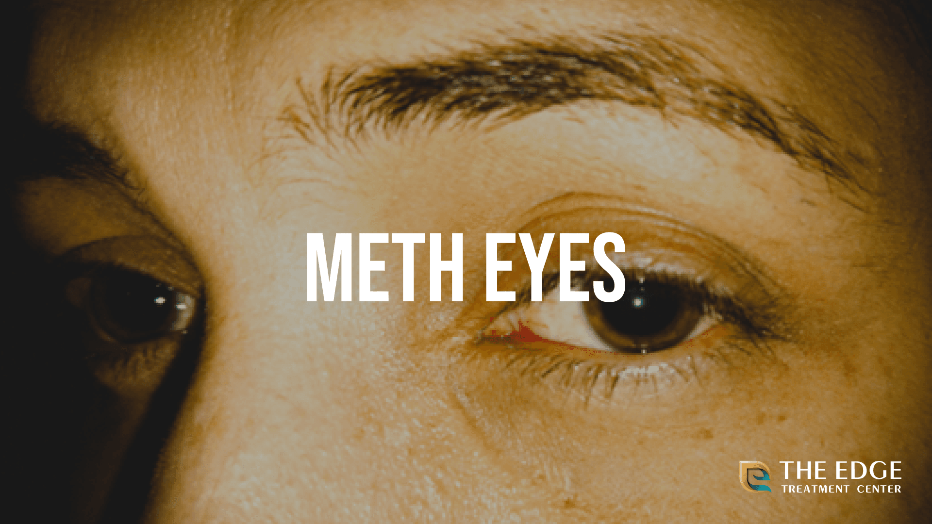 What are Meth Eyes?